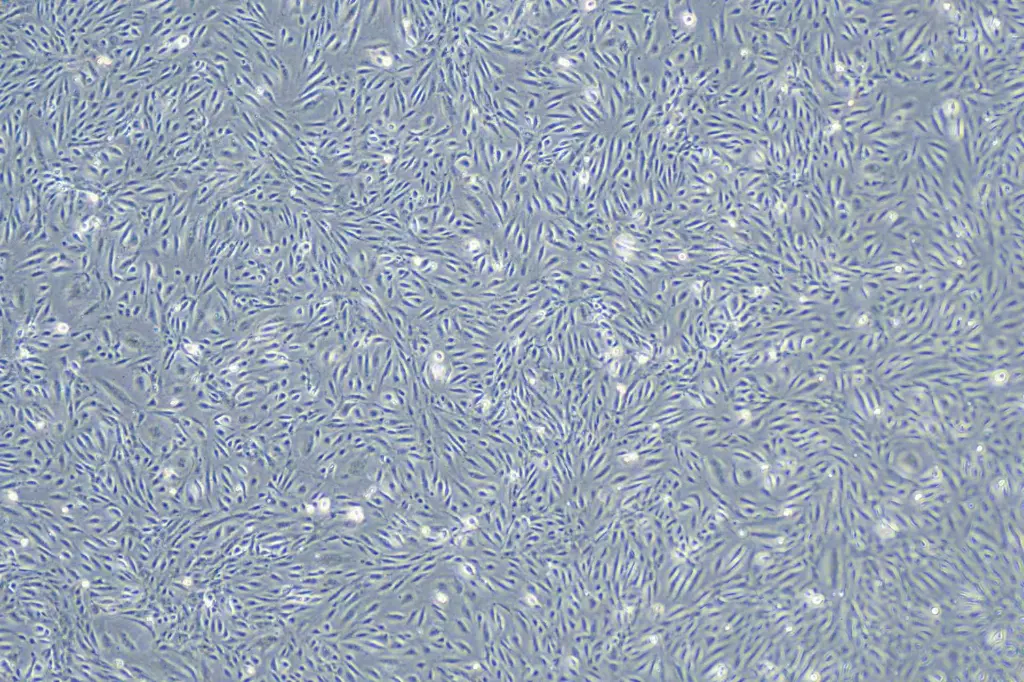 HUVEC-immortalized人脐静脉内皮细胞-永生化