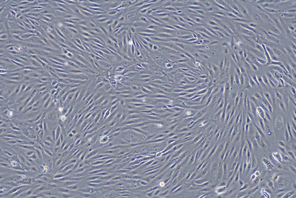 HUVEC原代人脐静脉内皮细胞