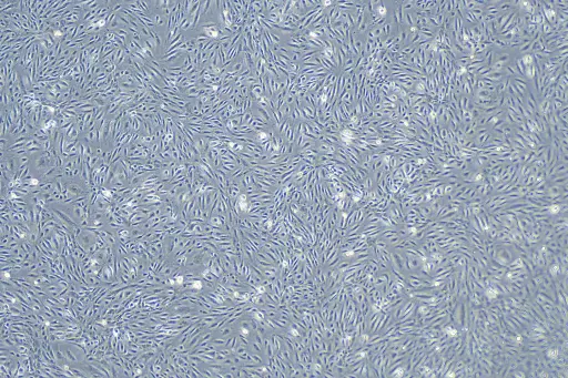 HUVEC-immortalized人脐静脉内皮细胞-永生化